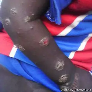 Report : Chemical Weapons Use